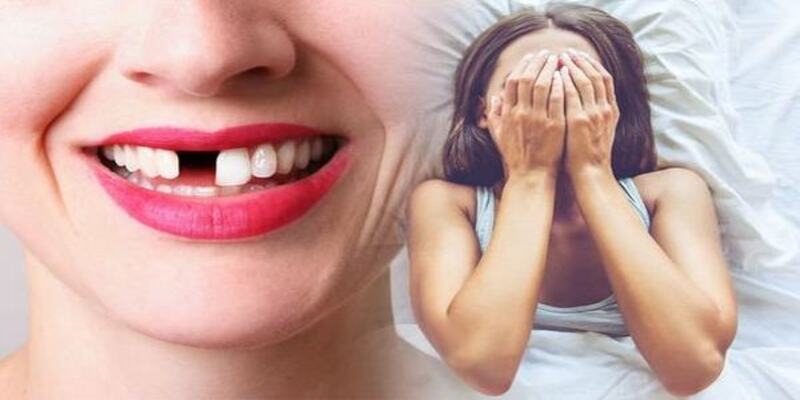 Nằm Mơ Rụng Răng Đánh Con Gì? Giải Đáp Chi Tiết Từ Cao Thủ