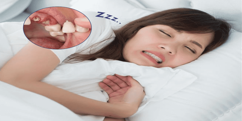 Lưu ý khi giải mã giấc mơ nằm mơ rụng răng đánh con gì
